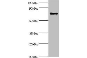 Western blot All lanes: SLC27A6 antibody at 4 μg/mL + MCF-7 whole cell lysate Secondary Goat polyclonal to rabbit IgG at 1/10000 dilution Predicted band size: 70 kDa Observed band size: 70 kDa (SLC27A6 Antikörper  (AA 370-619))