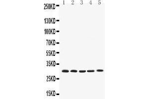Western blot analysis of Bcl-XL using anti-Bcl-XL antibody . (BCL2L1 Antikörper  (AA 1-219))