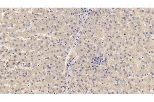 Detection of GPC3 in Human Liver Tissue using Monoclonal Antibody to Glypican 3 (GPC3) (Glypican 3 Antikörper  (AA 343-559))