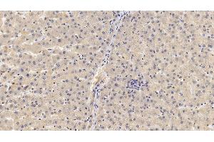 Detection of GPC3 in Human Liver Tissue using Monoclonal Antibody to Glypican 3 (GPC3)
