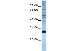 WB Suggested Anti-EIF4E Antibody Titration:  0. (EIF4E Antikörper  (C-Term))