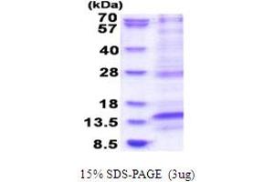 SDS-PAGE (SDS) image for Late Endosomal/lysosomal Adaptor, MAPK and mTOR Activator 4 (LAMTOR4) (AA 1-99) protein (His tag) (ABIN6387476)