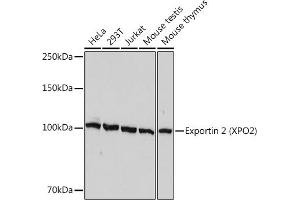 Western blot analysis of extracts of various cell lines, using Exportin 2 (XPO2) Rabbit mAb (ABIN7266533) at 1:1000 dilution. (Exportin 2 Antikörper)