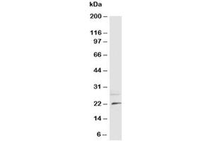 Western blot testing of NGF antibody and rat brain tissue lysate (Nerve Growth Factor Antikörper  (N-Term))