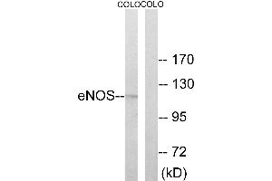 Western blot analysis of extracts from COLO cells, using Enos (Ab-494) antibody.