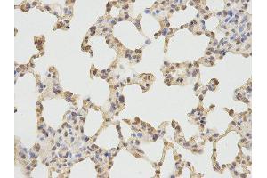 Immunohistochemistry (IHC) image for anti-Protein Kinase, CGMP-Dependent, Type I (PRKG1) antibody (ABIN1874320) (PRKG1 Antikörper)