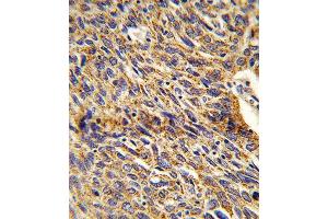 Immunohistochemistry (IHC) image for anti-Enoyl-CoA Delta Isomerase 1 (ECI1) antibody (ABIN3003901) (DCI Antikörper)