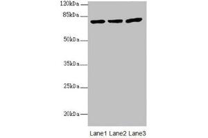 Western blot All lanes: KBTBD7 antibody at 1. (KBTBD7 Antikörper  (AA 475-684))