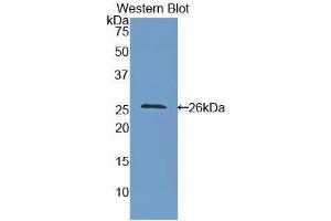 Western blot analysis of the recombinant protein. (ICAM4 Antikörper  (AA 32-226))