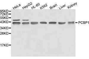 Western blot analysis of extracts of various cell lines, using PCBP1 antibody. (PCBP1 Antikörper)