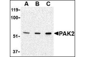 Western blot analysis of PAK2 in Jurkat lysate with this product at (A) 0. (PAK2 Antikörper  (N-Term))