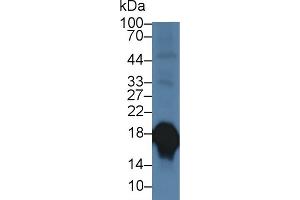 Detection of SOD1 in Porcine Cerebrum lysate using Polyclonal Antibody to Superoxide Dismutase 1 (SOD1) (SOD1 Antikörper  (AA 2-153))