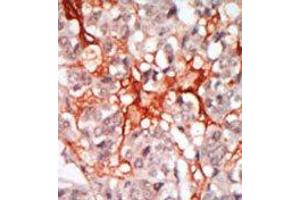 Image no. 1 for anti-Megakaryocyte-Associated tyrosine Kinase (MATK) (N-Term) antibody (ABIN359988) (MATK Antikörper  (N-Term))