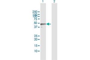 Western Blot analysis of TRIM62 expression in transfected 293T cell line by TRIM62 MaxPab polyclonal antibody. (TRIM62 Antikörper  (AA 1-475))