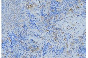 ABIN6276777 at 1/100 staining Human lymph node tissue by IHC-P.