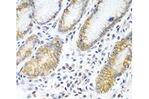 Immunohistochemistry of paraffin-embedded Human stomach using ATAD3A Polyclonal Antibody at dilution of 1:100 (40x lens). (ATAD3A Antikörper)
