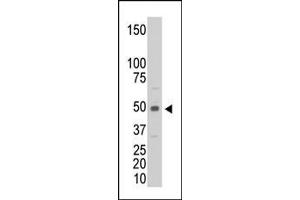 The anti-CKM Pab (ABIN391096 and ABIN2841235) is used in Western blot to detect CKM in C6 cell lysate. (CKM Antikörper  (C-Term))