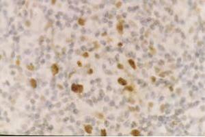 Staining of CD55 on formalin fixed paraffin embedded lymphnode (heat treated with citrate buffer retrieval) using SM1141Pdiluted1/100 (CD55 Antikörper)
