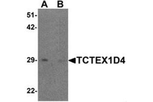 Western blot analysis of TCTEX1D4 in mouse liver tissue lysate with TCTEX1D4 antibody at 1 ug/mL in (A) the absence and (B) the presence of blocking peptide. (TCTEX1D4 Antikörper  (N-Term))