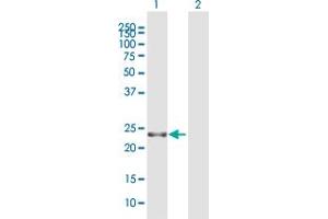 Western Blot analysis of RTN3 expression in transfected 293T cell line by RTN3 MaxPab polyclonal antibody. (Reticulon 3 Antikörper  (AA 1-236))
