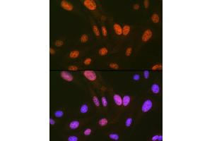 Immunofluorescence analysis of U-2 OS cells using HIPK2 Rabbit mAb (ABIN7267779) at dilution of 1:100 (40x lens). (HIPK2 Antikörper)