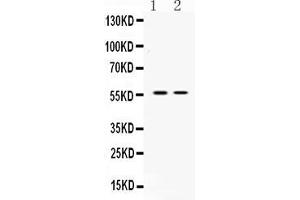 Western blot analysis of ANGPTL2 expression in rat stomach extract ( Lane 1) and mouse ovary extract ( Lane 2). (ANGPTL2 Antikörper  (Middle Region))