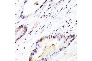 Immunohistochemistry (IHC) image for anti-Fibroblast Growth Factor 12 (FGF12) (AA 1-181) antibody (ABIN1679841)