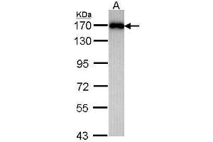 WB Image Sample (30 ug of whole cell lysate) A: Raji 7. (MAGI2 Antikörper  (C-Term))