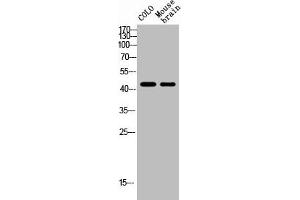 Western Blot analysis of MOUSE-BRAIN COLO cells using NK-1R Polyclonal Antibody (TACR1 Antikörper  (Internal Region))