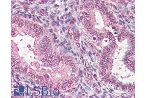 ABIN190811 (5µg/ml) staining of paraffin embedded Human Uterus.