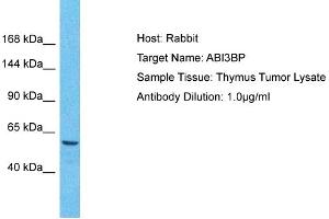 Host: Rabbit Target Name: ABI3BP Sample Tissue: Human Thymus Tumor Antibody Dilution: 1ug/ml (ABI3BP Antikörper  (C-Term))