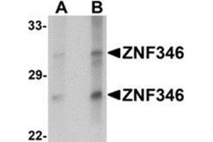 Western blot analysis of ZNF346 in human kidney tissue lysate with ZNF346 antibody at (A) 1 and (B) 2 μg/ml.