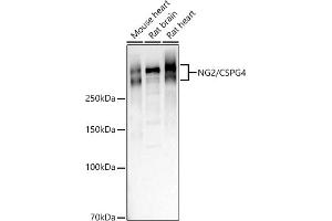 Western blot analysis of extracts of various cell lines, using NG2/CSPG4 antibody (ABIN1679389, ABIN3017852, ABIN3017853 and ABIN5664347) at 1:1000 dilution. (NG2 Antikörper  (AA 1950-2210))