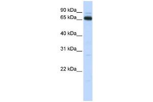 WB Suggested Anti-KBTBD5 Antibody Titration:  0.