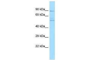 Host: Rabbit Target Name: PPEF2 Sample Type: PANC1 Whole Cell lysates Antibody Dilution: 1. (PPEF2 Antikörper  (C-Term))