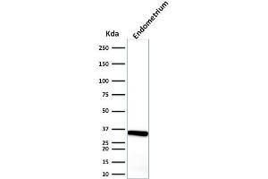 Western Blot Analysis of endometrium using Calponin-1 Mouse Monoclonal Antibody (CALP). (CNN1 Antikörper)