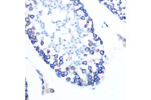 Immunohistochemistry of paraffin-embedded mouse testis using Lamin B1 Rabbit mAb (ABIN7268180) at dilution of 1:100 (40x lens). (Lamin B1 Antikörper)