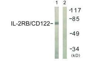 Western blot analysis of extracts from COS7 cells, using IL-2Rβ/CD122 (Ab-364) antibody. (IL2 Receptor beta Antikörper  (Tyr364))