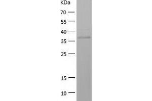 HAO1 Protein (AA 1-370) (His tag)