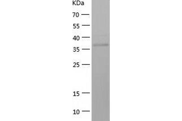 HAO1 Protein (AA 1-370) (His tag)