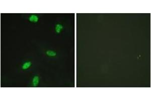Immunofluorescence analysis of HeLa cells, using Retinoblastoma (Phospho-Thr821) Antibody. (Retinoblastoma Protein (Rb) Antikörper  (pThr821))