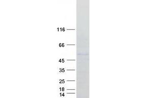 Validation with Western Blot