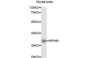 Western blot analysis of extracts of mouse brain, using EFNB1 antibody (ABIN6290364) at 1:1000 dilution. (Ephrin B1 Antikörper)