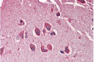 ABIN570801 (5µg/ml) staining of paraffin embedded Human Cortex. (Adlican Antikörper  (Internal Region))