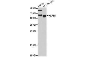 Western blot analysis of extracts of various cell lines, using KLRB1 antibody.
