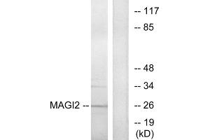 Western blot analysis of extracts from HT-29 cells, using MAGI2 antibody. (MAGI2 Antikörper  (Internal Region))