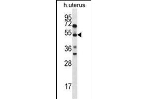 ABRA Antibody (C-term) (ABIN656755 and ABIN2845977) western blot analysis in human normal Uterus tissue lysates (35 μg/lane). (ABRA Antikörper  (C-Term))