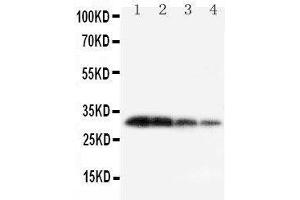 Lane 4: Recombinant Mouse KLK1 Protein 1. (Kallikrein 1 Antikörper  (C-Term))