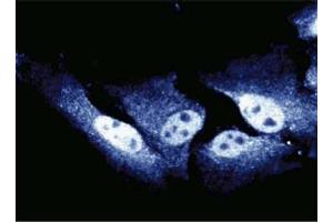 Immunofluorescent staining of HeLa cells. (CDC27 Antikörper  (AA 145-343))