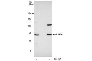 IP Image Immunoprecipitation of RPA70 protein from 293T whole cell extracts using 5 μg of RPA70 antibody [C1C3], Western blot analysis was performed using RPA70 antibody [C1C3], EasyBlot anti-Rabbit IgG  was used as a secondary reagent.